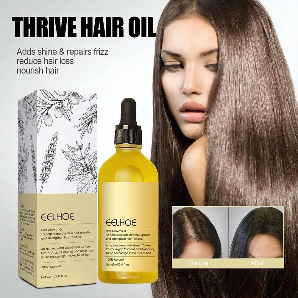Natural Hair Growth Oil Fomnin Shop 0122
