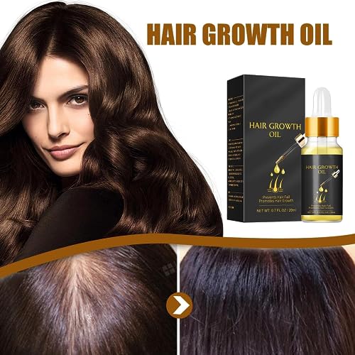 Tress Diary Hair Growth Oil - Fomnin Shop